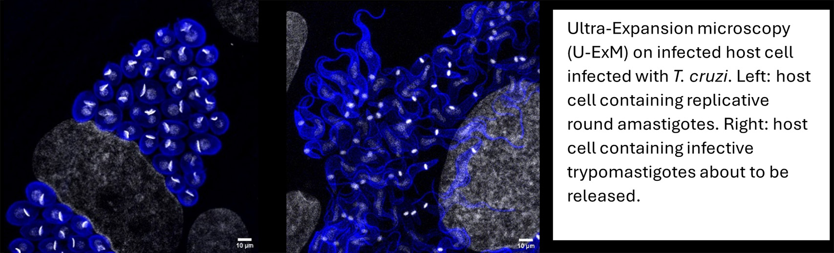 ultra expension microscopy in infected host cell